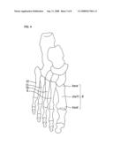 Production Method for Sole Plate diagram and image