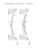 Lordosis Support diagram and image