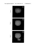 METHODS FOR FAT SIGNAL SUPPRESSION IN MAGNETIC RESONANCE IMAGING diagram and image