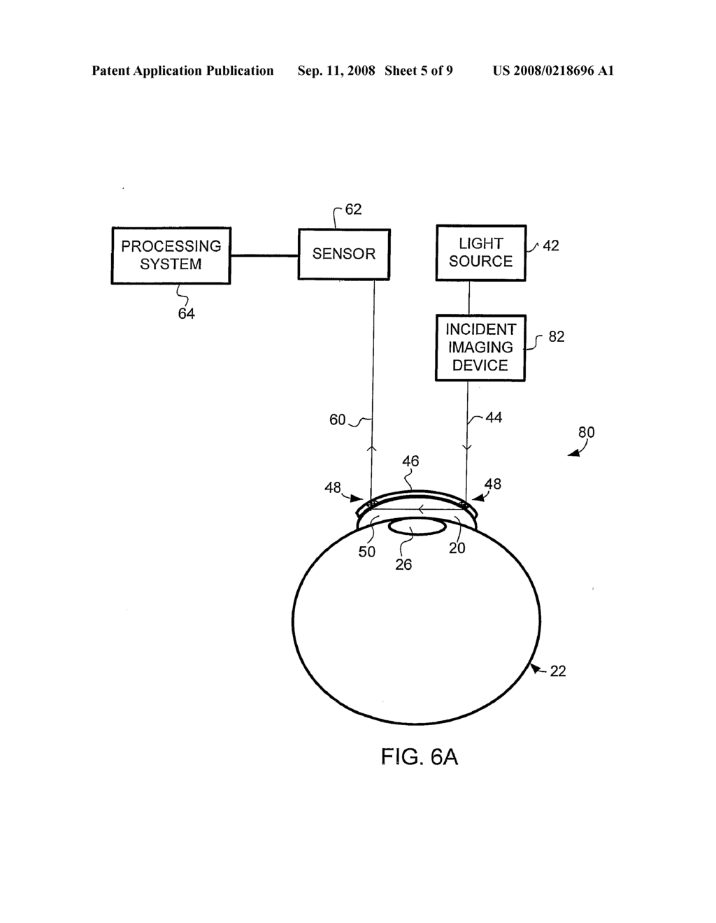 Non-Invasive Monitoring System - diagram, schematic, and image 06