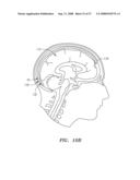 Robotic surgical instrument and methods using bragg fiber sensors diagram and image