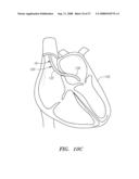 Robotic surgical instrument and methods using bragg fiber sensors diagram and image