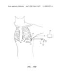 Robotic surgical instrument and methods using bragg fiber sensors diagram and image