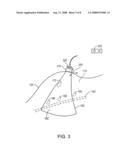 System and method for patient setup for radiotherapy treatment diagram and image