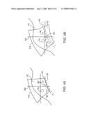 System and method for patient setup for radiotherapy treatment diagram and image