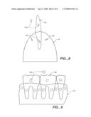 Methods and Devices for Quantitative Analysis of X-Ray Images diagram and image