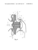 Turbine Part of a Turbocompressor and a Method of Avoiding Carbon Build-Up in the Turbine Part of a Turbocompressor diagram and image