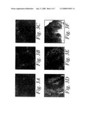 Soluble lymphotoxin-beta receptors and anti-lymphotoxin receptor and ligand antibodies as therapeutic agents for the treatment of immunological diseases diagram and image