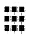 Soluble lymphotoxin-beta receptors and anti-lymphotoxin receptor and ligand antibodies as therapeutic agents for the treatment of immunological diseases diagram and image