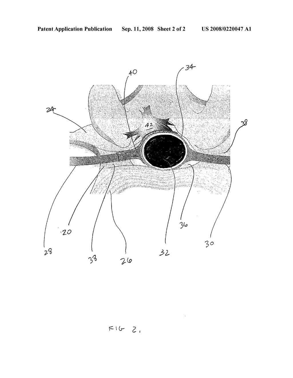 Low-swelling biocompatible hydrogels - diagram, schematic, and image 03