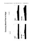 Red blood cells loaded with s-nitrosothiol and uses therefor diagram and image