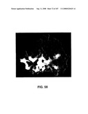 Methods and Compositions for Detecting Target Sequences diagram and image