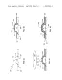 AIR BREAK FOR IMPROVED SILICIDE FORMATION WITH COMPOSITE CAPS diagram and image