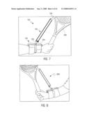 TENNIS TRAINING AID diagram and image