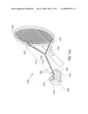 TENNIS TRAINING AID diagram and image