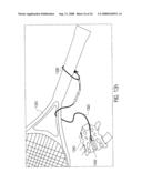 TENNIS TRAINING AID diagram and image