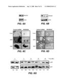 Method of Diagnosing and Treating Glioma diagram and image