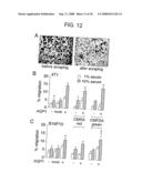 Modulation of Aquaporin in Modulation of Angiogenesis and Cell Migration diagram and image