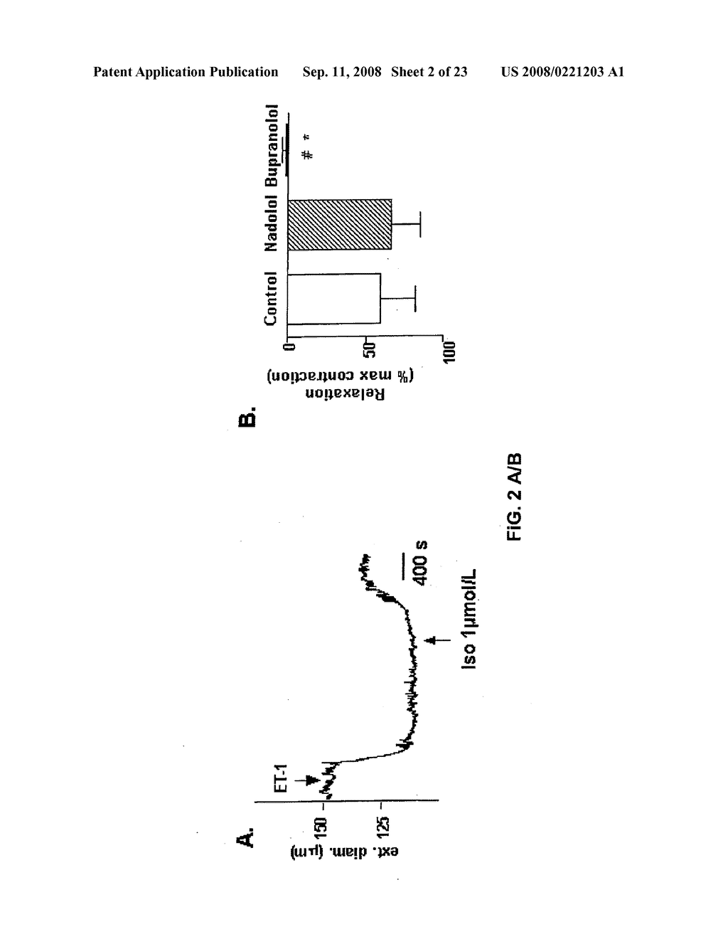 Use of Agonists and Antagonists of Beta Adrenoceptors for Treating Arterial Disease - diagram, schematic, and image 03