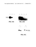 MN Gene and Protein diagram and image