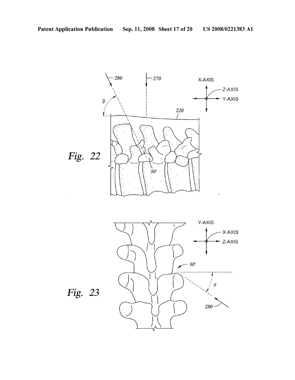 TISSUE EXCISION DEVICES AND METHODS - diagram, schematic, and image 18