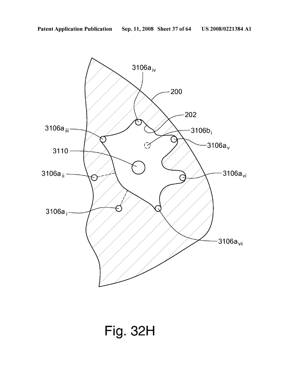 EXPANDABLE BRACHYTHERAPY APPARATUS AND METHODS FOR USING THEM - diagram, schematic, and image 38