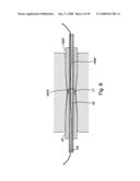 Devices for minimally invasive pelvic surgery diagram and image