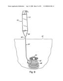 Devices for minimally invasive pelvic surgery diagram and image