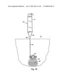 Devices for minimally invasive pelvic surgery diagram and image