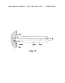 Devices for minimally invasive pelvic surgery diagram and image