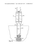 Devices for minimally invasive pelvic surgery diagram and image