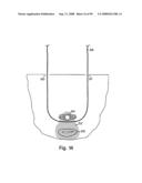 Devices for minimally invasive pelvic surgery diagram and image