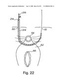 Devices for minimally invasive pelvic surgery diagram and image