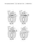 Devices for minimally invasive pelvic surgery diagram and image