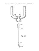 Devices for minimally invasive pelvic surgery diagram and image