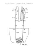 Devices for minimally invasive pelvic surgery diagram and image