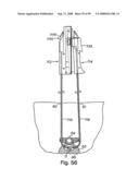 Devices for minimally invasive pelvic surgery diagram and image