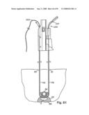 Devices for minimally invasive pelvic surgery diagram and image