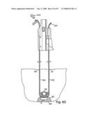 Devices for minimally invasive pelvic surgery diagram and image