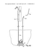 Devices for minimally invasive pelvic surgery diagram and image