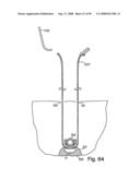 Devices for minimally invasive pelvic surgery diagram and image
