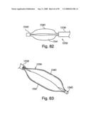 Devices for minimally invasive pelvic surgery diagram and image