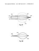 Devices for minimally invasive pelvic surgery diagram and image