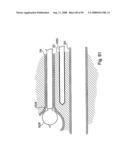 Devices for minimally invasive pelvic surgery diagram and image