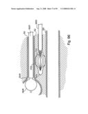 Devices for minimally invasive pelvic surgery diagram and image