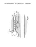 Devices for minimally invasive pelvic surgery diagram and image