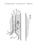 Devices for minimally invasive pelvic surgery diagram and image