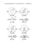 Devices for minimally invasive pelvic surgery diagram and image