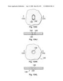 Devices for minimally invasive pelvic surgery diagram and image