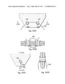 Devices for minimally invasive pelvic surgery diagram and image